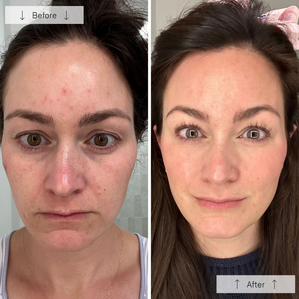 Omnilux Contour Face